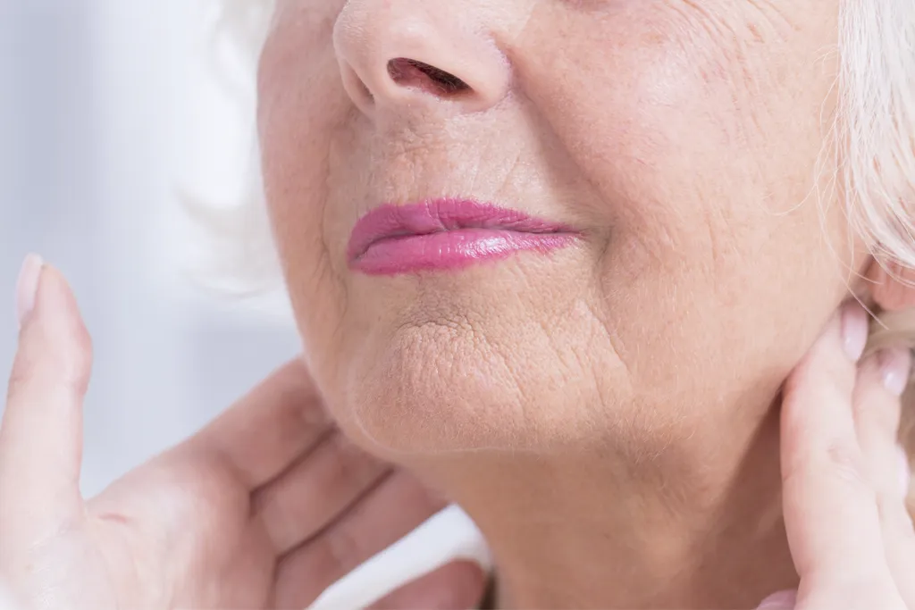 Embrace RF de InMode