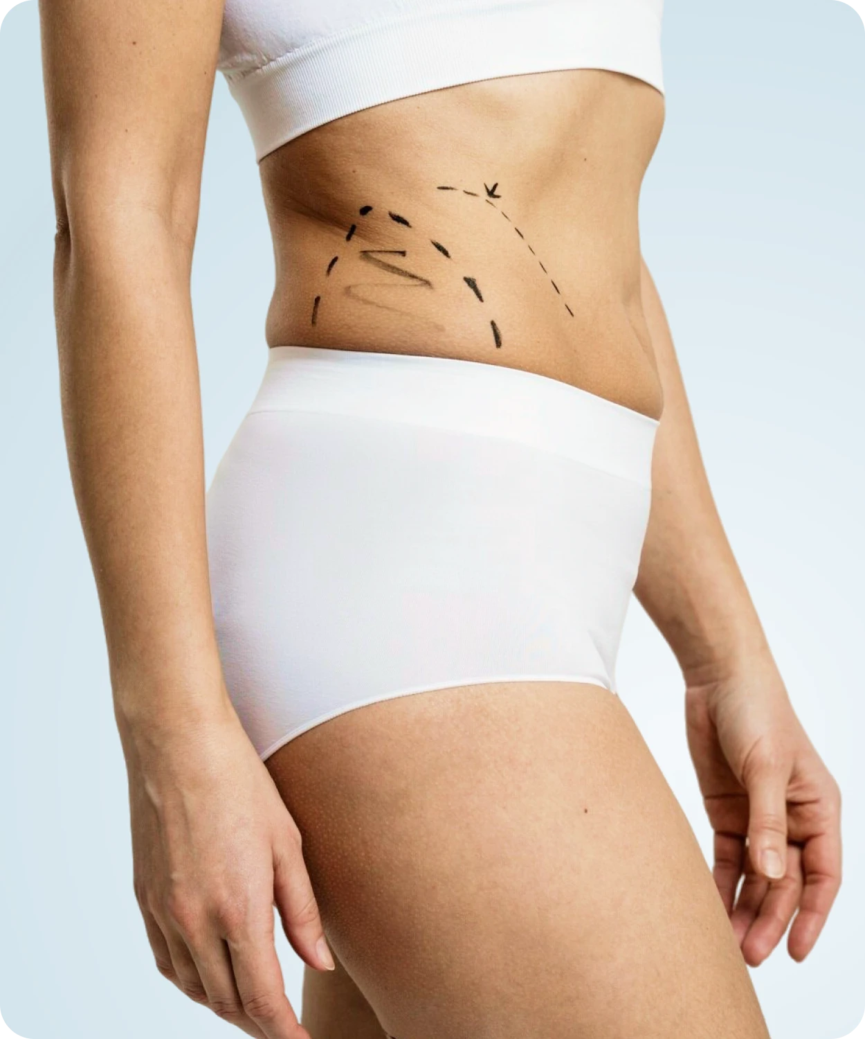 Primera vista de liposucción