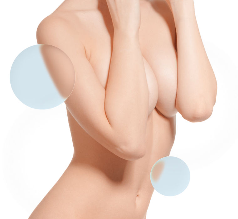 Recambio prótesis mama Barcelona