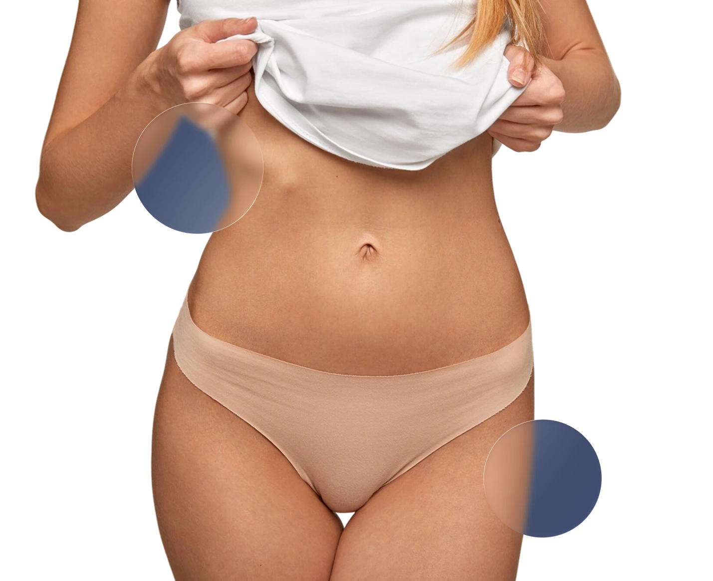 Labioplastia de aumento