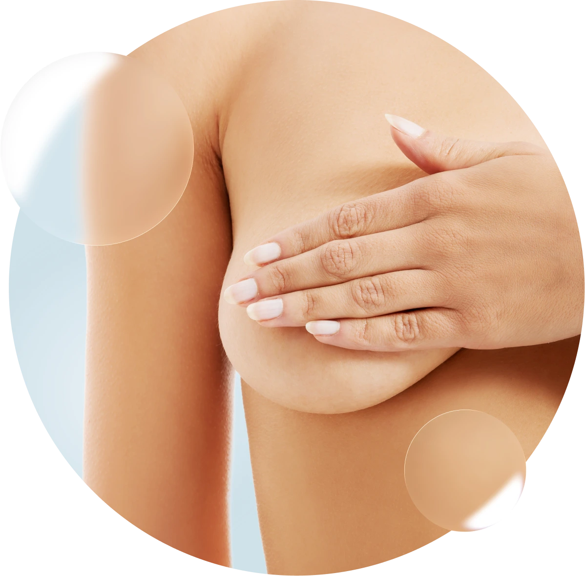 Mastectomía radical