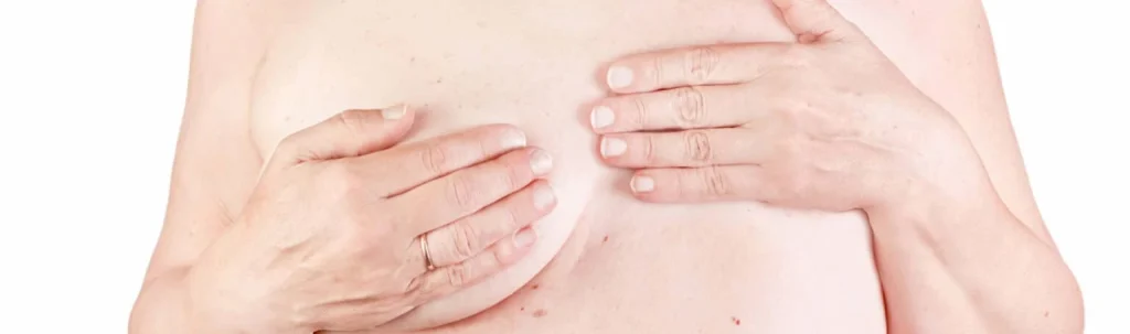 Cirugía reparadora mamaria